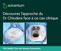 Découvrez l'approche du Dr Chiodera face à ce cas cliniques